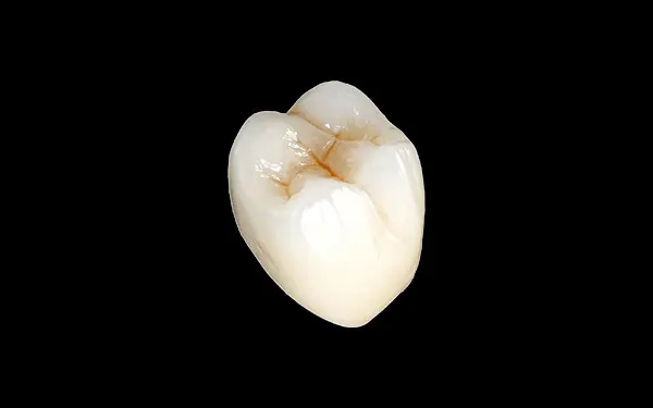 Full-Zirconia