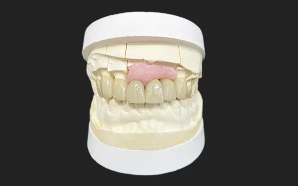 Multilayer Zirconia