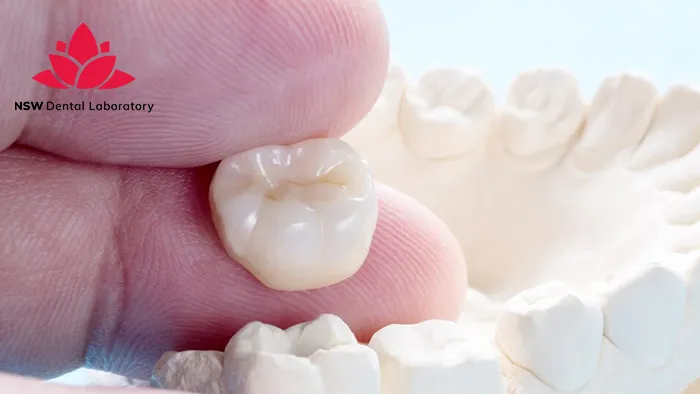 Helpful Things To Know About Crown On A Tooth