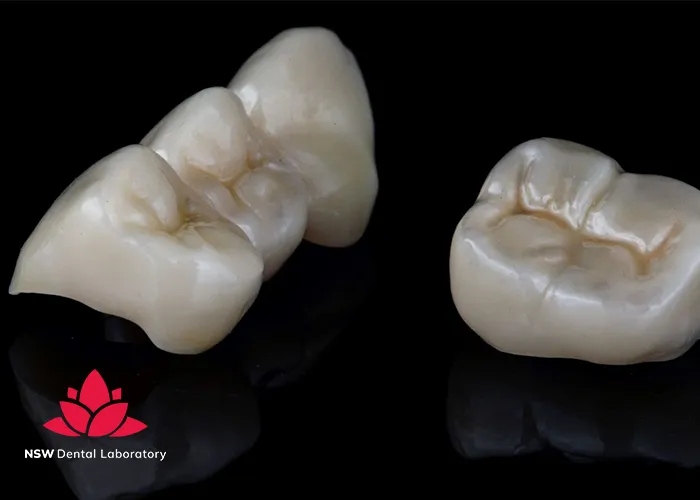 Nsw-Dental-Lab-The-Best-Dental-Crown-Lab-For-You