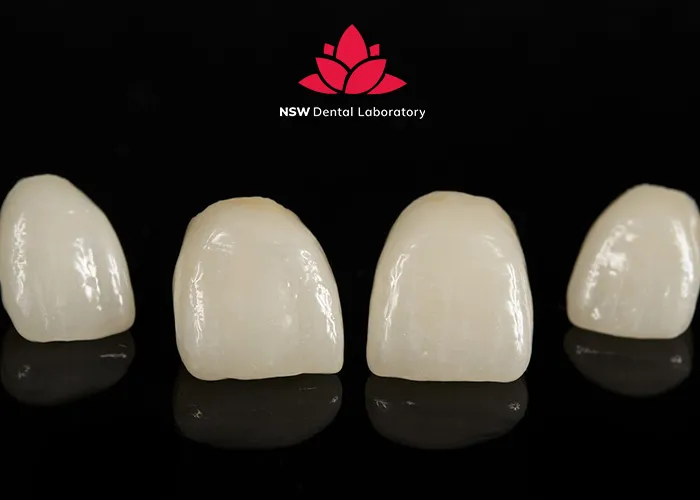 Nsw-Dental-Lab-The-Best-Dental-Crown-Lab-For-You