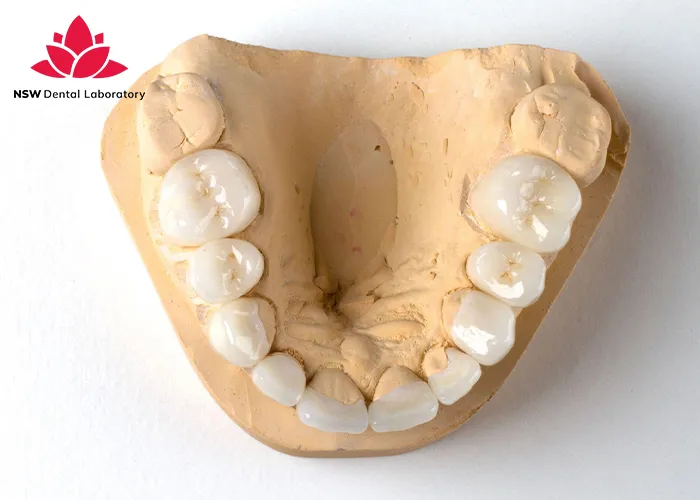 Nsw-Dental-Lab-The-Best-Dental-Crown-Lab-For-You