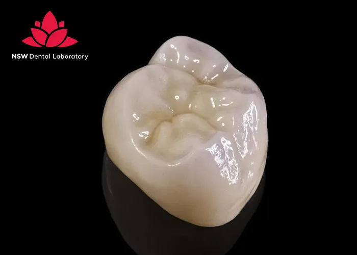 Which-Material-Is-The-Best-For-The-Crown-On-A-Molar?