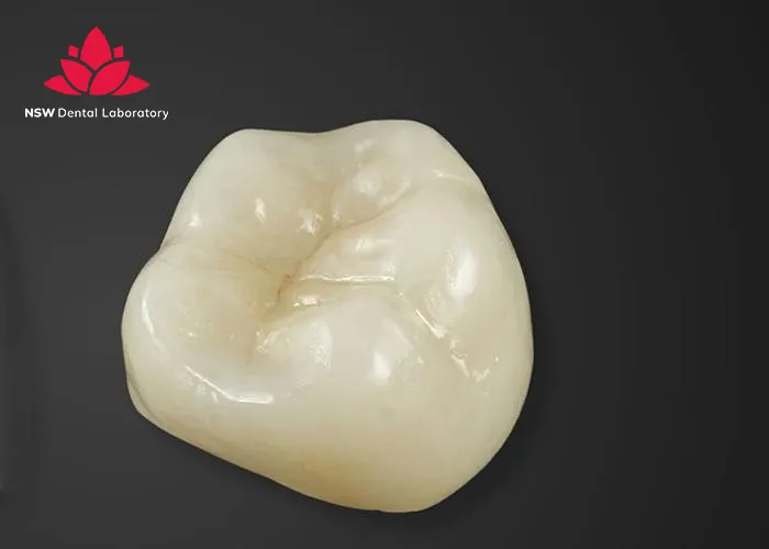 Which-Material-Is-The-Best-For-The-Crown-On-A-Molar?