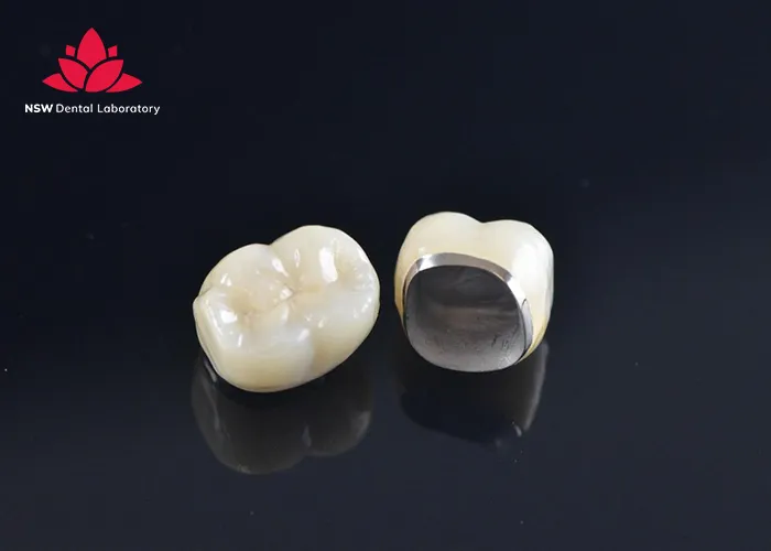 Which-Material-Is-The-Best-For-The-Crown-On-A-Molar?