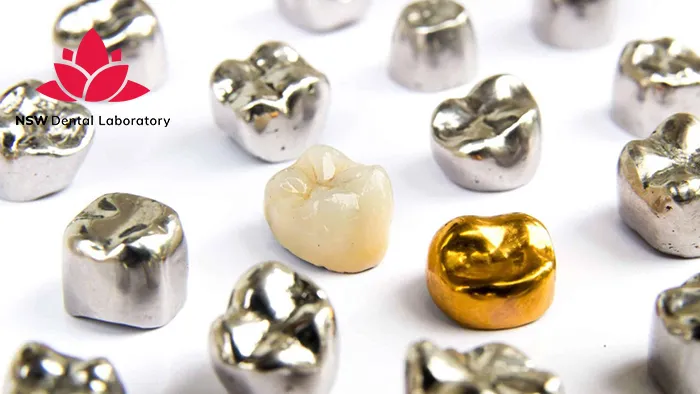 Best Types Of Dental Crown Material