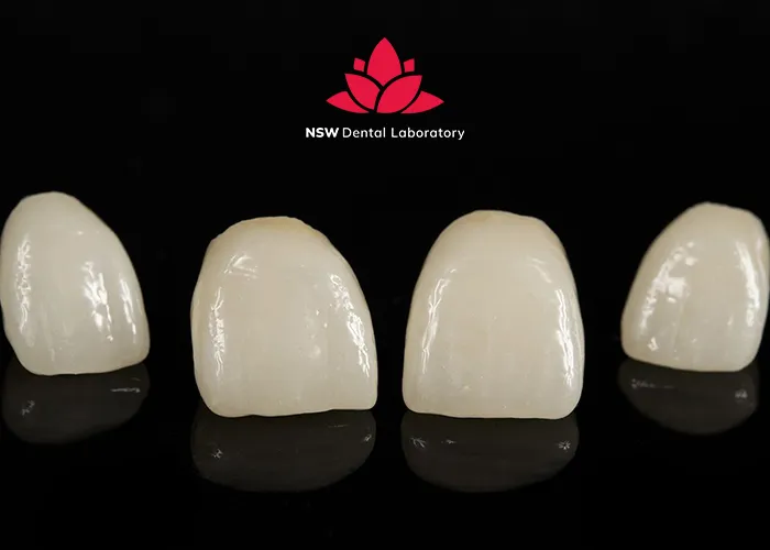 Best-types-of-dental-crown-material