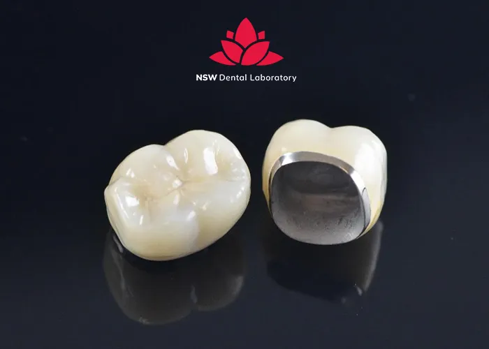 Best-types-of-dental-crown-material