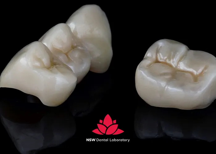 Best-types-of-dental-crown-material