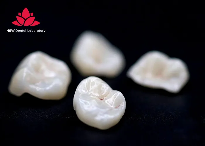 Best-types-of-dental-crown-material