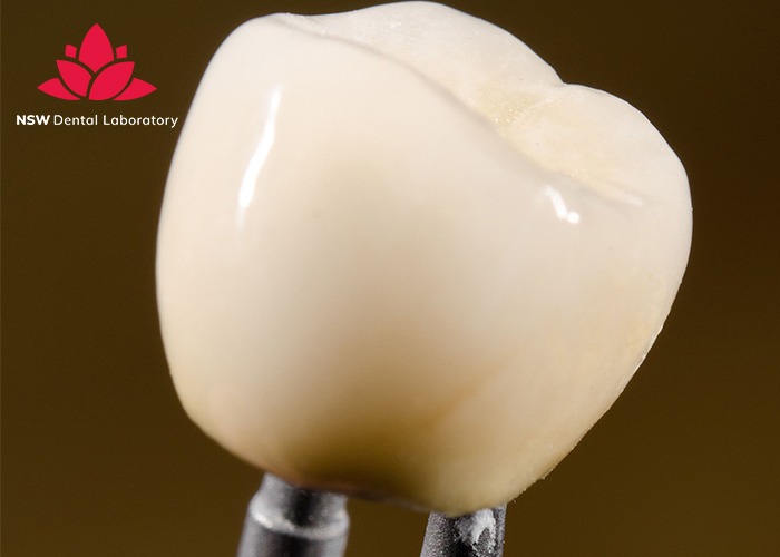 A Detailed Dental Crown Procedure: Helpful Things You Should Know