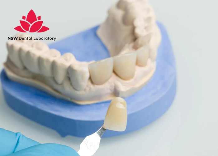 A Detailed Dental Crown Procedure: Helpful Things You Should Know