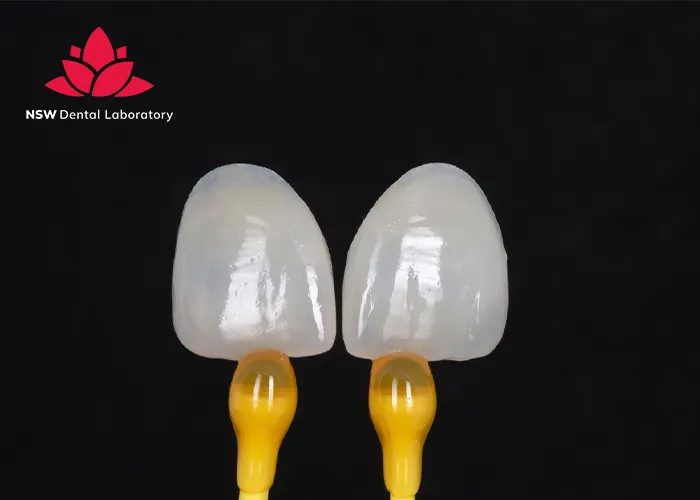 Emax-Crowns-Learn-About-A-Strong-And-Beautiful-Ceramic