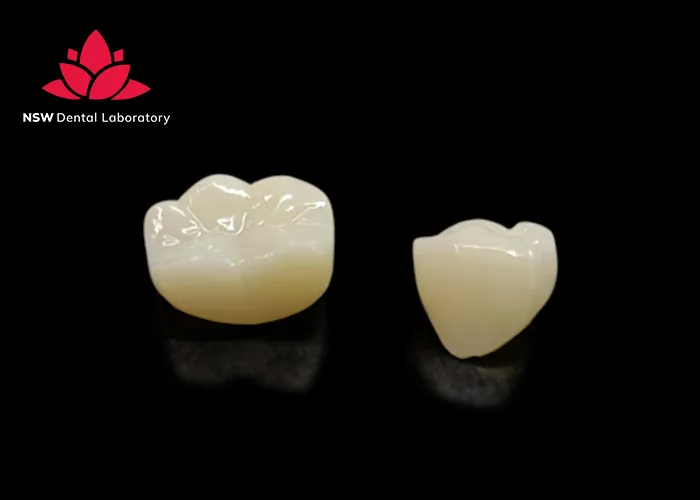 Emax-Crowns-Learn-About-A-Strong-And-Beautiful-Ceramic