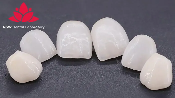 Emax Crowns: Learn About A Strong And Beautiful Ceramic