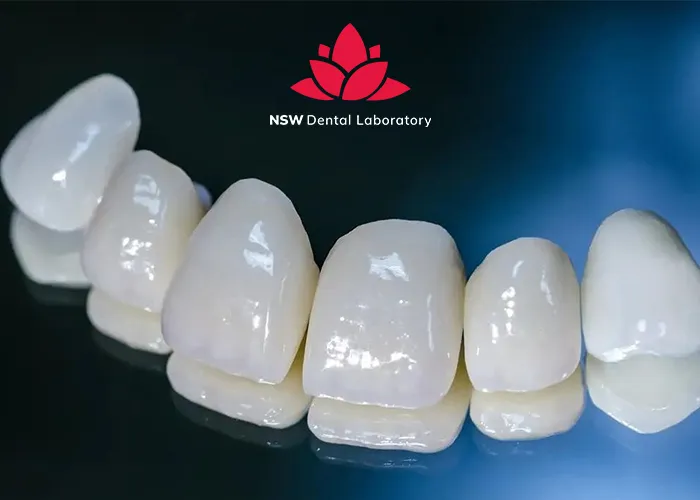 Emax-Crowns-Learn-About-A-Strong-And-Beautiful-Ceramic