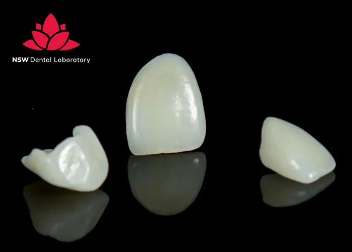 Emax-Crowns-Learn-About-A-Strong-And-Beautiful-Ceramic