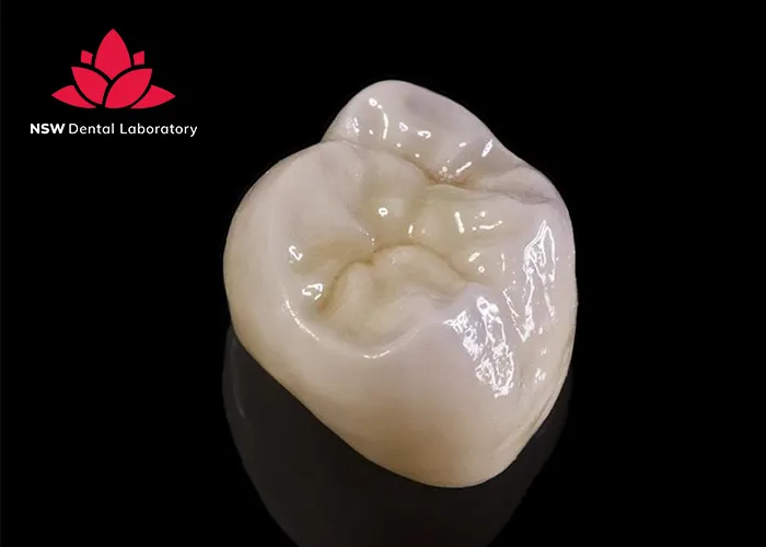 Emax-Crowns-Learn-About-A-Strong-And-Beautiful-Ceramic