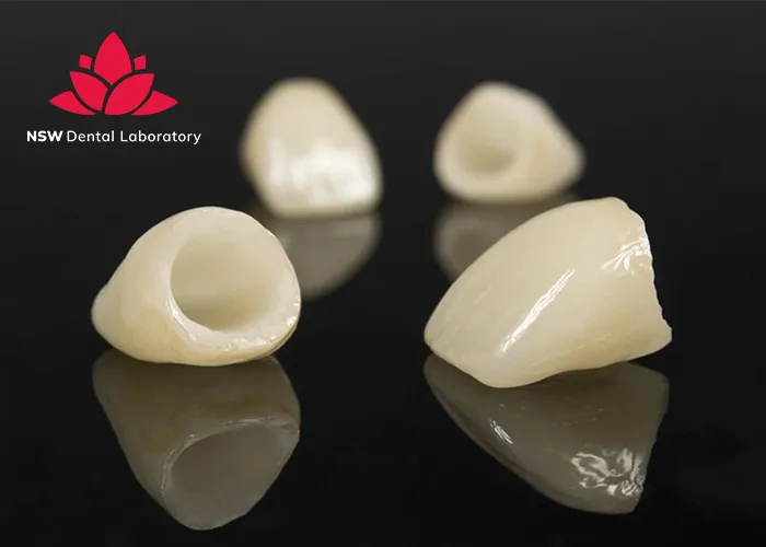 Emax-Crowns-Learn-About-A-Strong-And-Beautiful-Ceramic