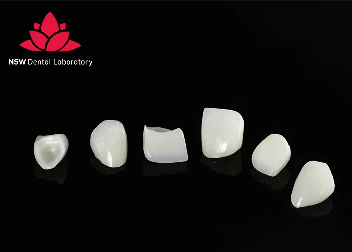 Discover-Why-Placing-A-Front-Tooth-Crown-Is-More-Challenging