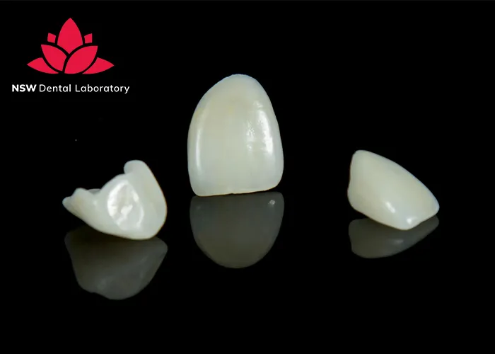 Discover-Why-Placing-A-Front-Tooth-Crown-Is-More-Challenging