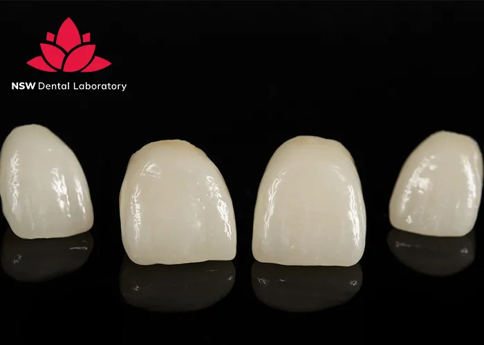 Discover-Why-Placing-A-Front-Tooth-Crown-Is-More-Challenging