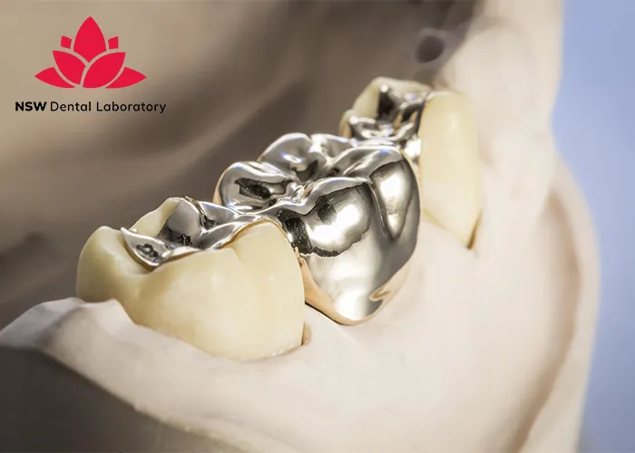 Comprehensive-Understanding-Of-Gold-Dental-Crowns-In-Modern-Dentistry