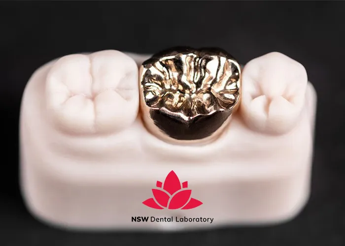 Comprehensive-Understanding-Of-Gold-Dental-Crowns-In-Modern-Dentistry