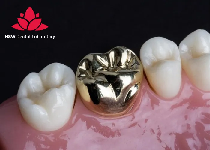 Comprehensive-Understanding-Of-Gold-Dental-Crowns-In-Modern-Dentistry