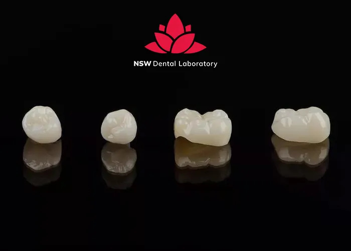 PFM Crowns Vs Zirconia Crowns: The Best Choice For You