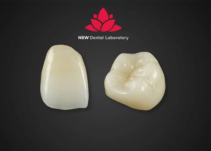 PFM Crowns Vs Zirconia Crowns: The Best Choice For You