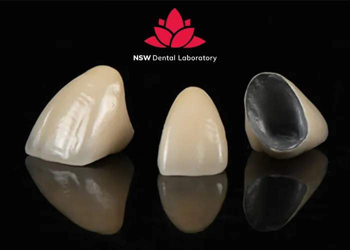 PFM Crowns Vs Zirconia Crowns: The Best Choice For You