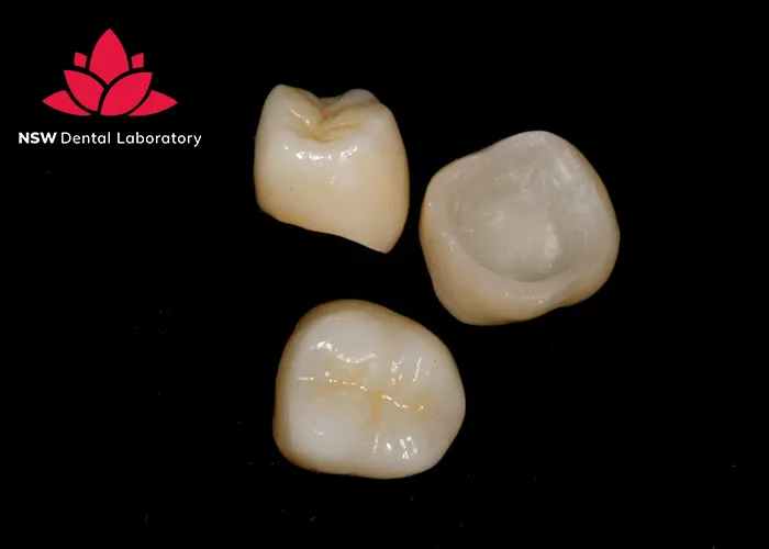 PFM Crowns Vs Zirconia Crowns: The Best Choice For You