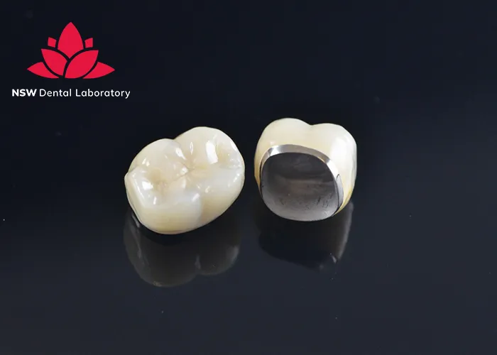 PFM Crowns Vs Zirconia Crowns: The Best Choice For You