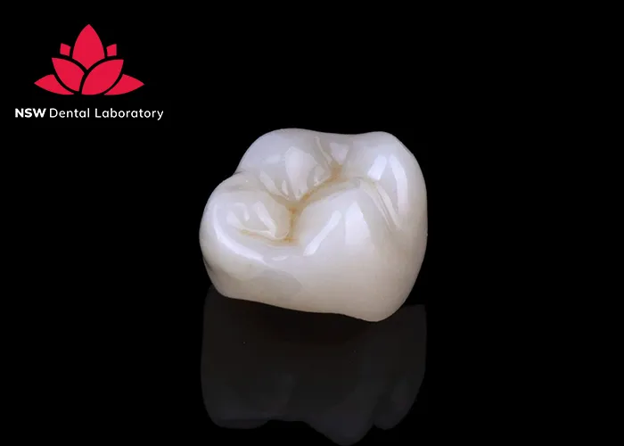 PFM Crowns Vs Zirconia Crowns: The Best Choice For You