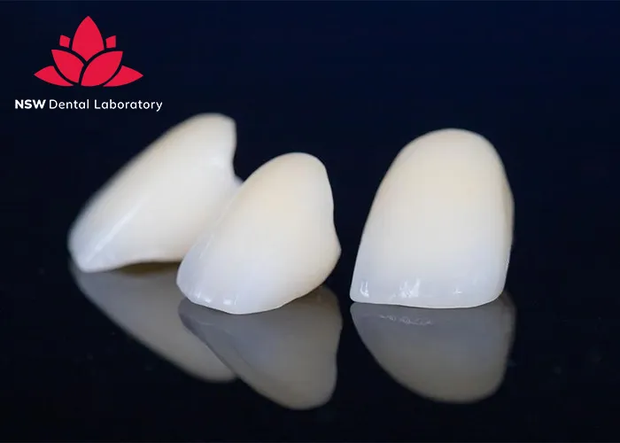 Comprehensive-Benefits-Of-Porcelain-Crowns