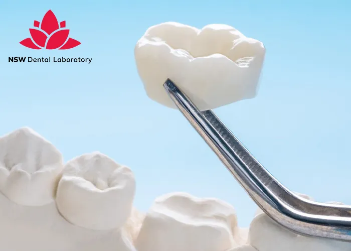 Comprehensive-Benefits-Of-Porcelain-Crowns