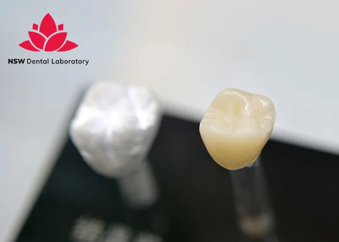 Comprehensive-Benefits-Of-Porcelain-Crowns