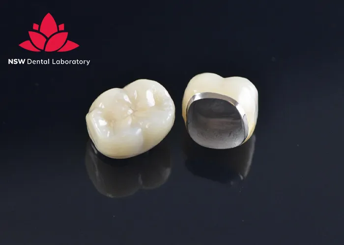 Comprehensive-Benefits-Of-Porcelain-Crowns