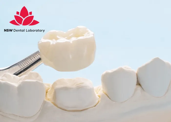 A-Comprehensive-Guide-To-Different-Types-Of-Dental-Crowns