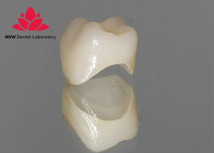 A-Comprehensive-Guide-To-Different-Types-Of-Dental-Crowns