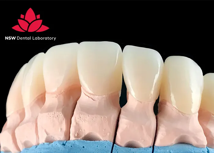 A-Comprehensive-Guide-To-Different-Types-Of-Dental-Crowns