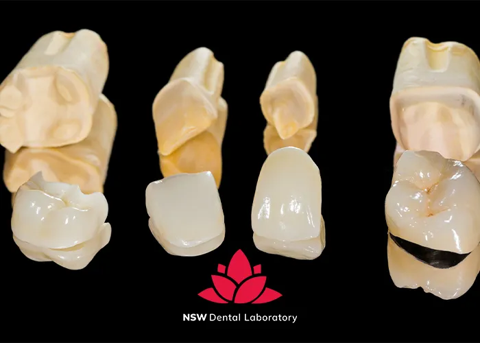 A-Comprehensive-Guide-To-Different-Types-Of-Dental-Crowns