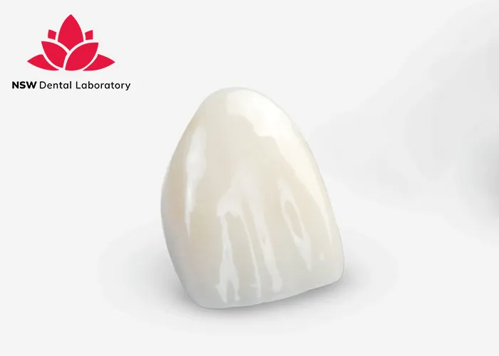 A-Comprehensive-Guide-To-Different-Types-Of-Dental-Crowns