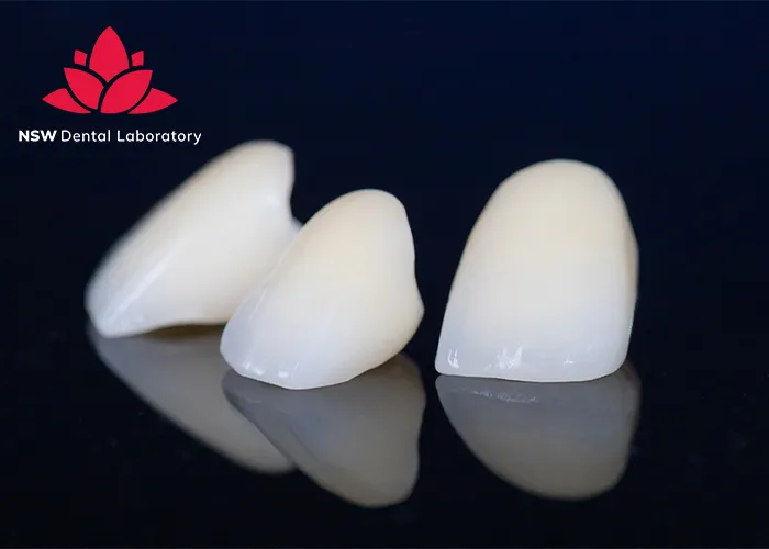 A-Comprehensive-Guide-To-Different-Types-Of-Dental-Crowns