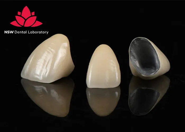 A-Comprehensive-Guide-To-Different-Types-Of-Dental-Crowns