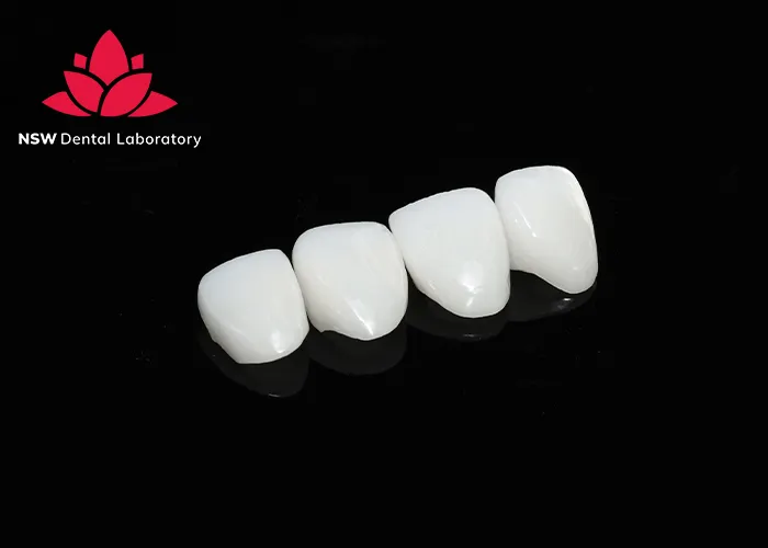 A-Comprehensive-Guide-To-Different-Types-Of-Dental-Crowns