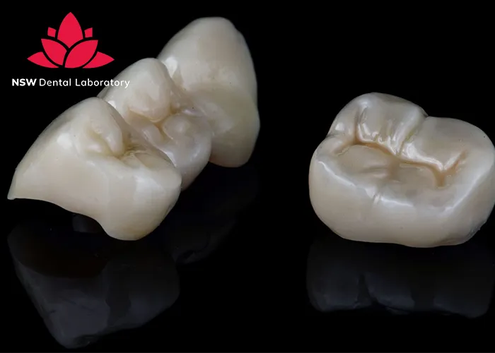 A-Comprehensive-Guide-To-Different-Types-Of-Dental-Crowns