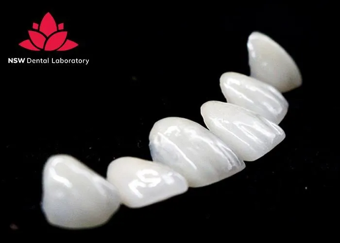 Improved-Your-Smile-With-Dental-Crown-NSW