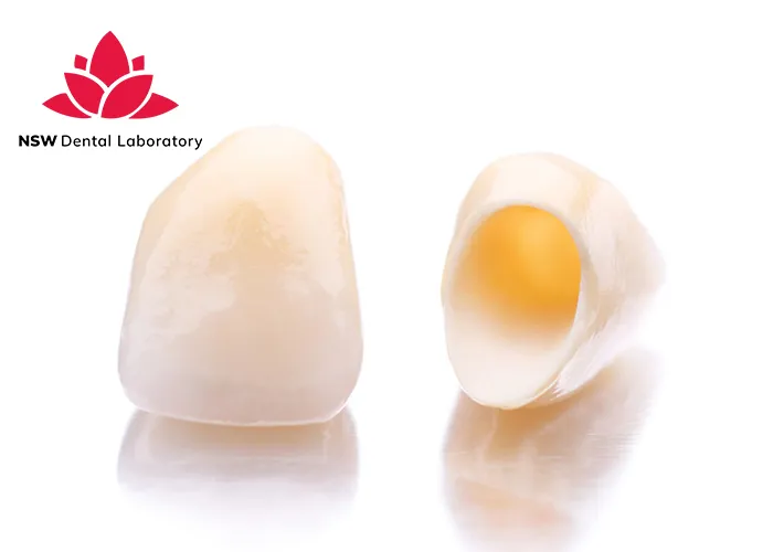 Improved-Your-Smile-With-Dental-Crown-NSW